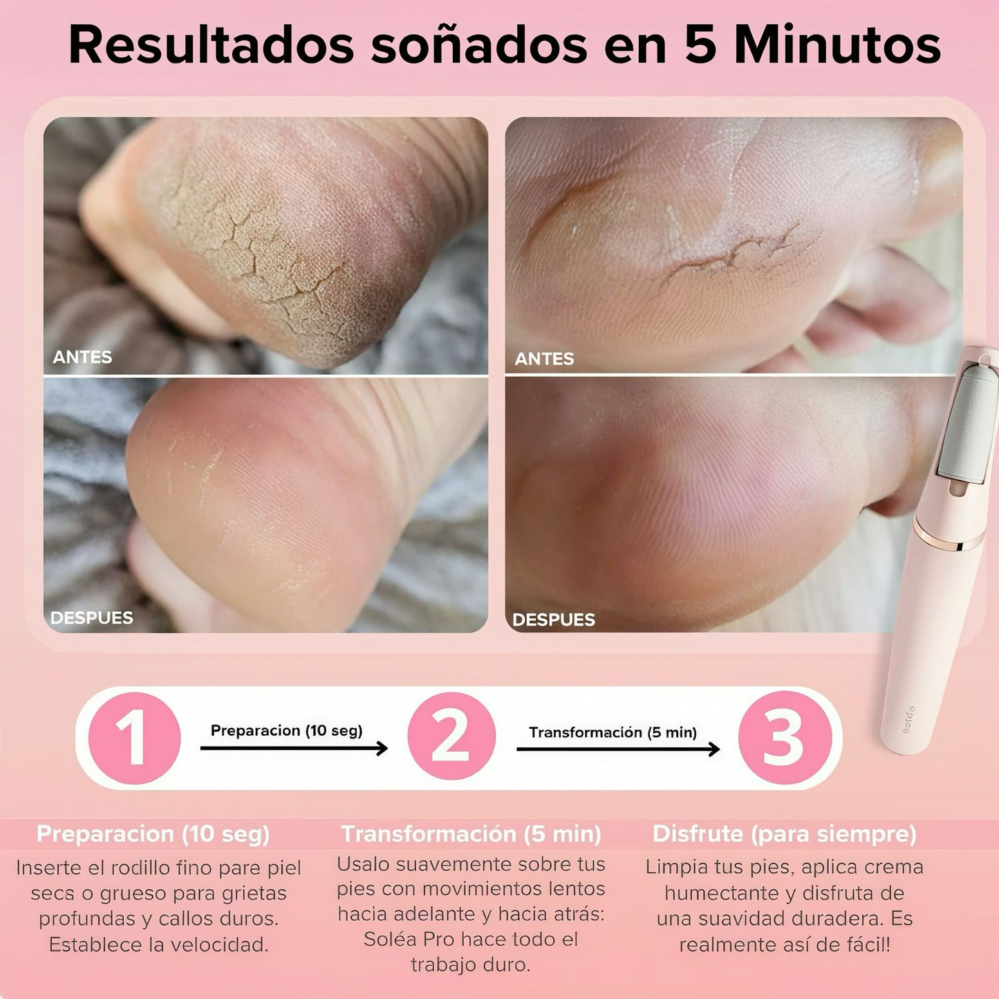 PediLuxe® Suavidad de spa en casa.